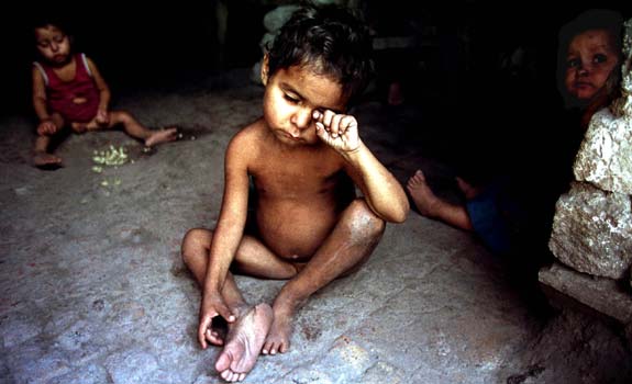 Miles de niños mueren de hambre cada año