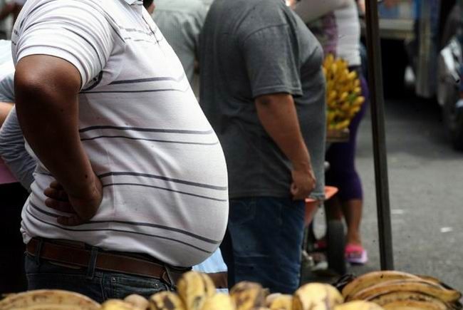 Obesidad Cuba