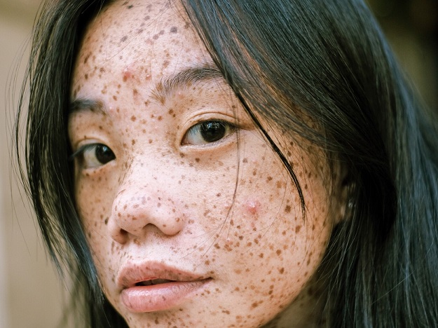 Cara-pecas